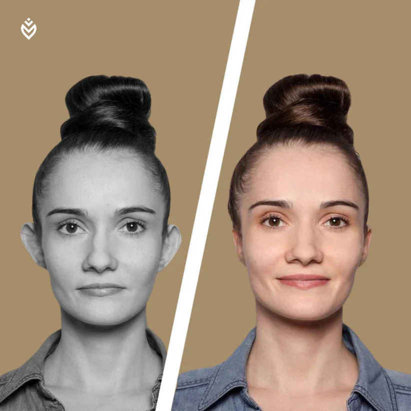 Novas™ Ear Correctors